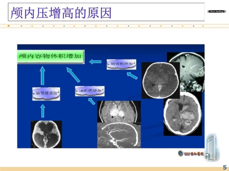 颅内高压的护理资料教程_第5页