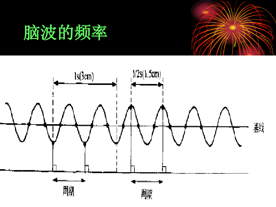 脑电图判读教学幻灯片_第3页