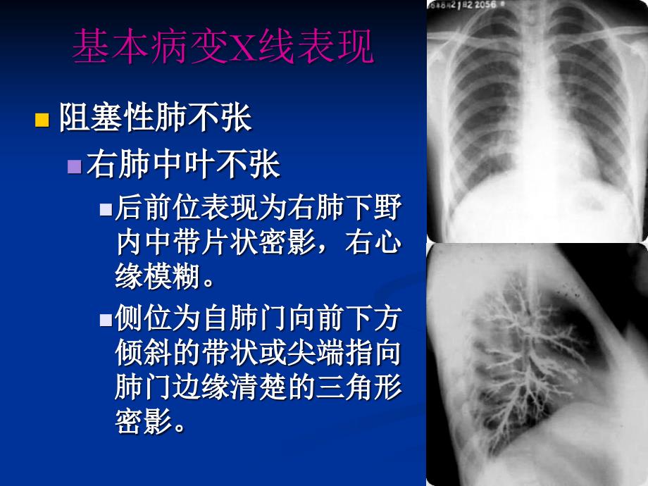 重庆益民医院呼吸系统ppt课件_第4页