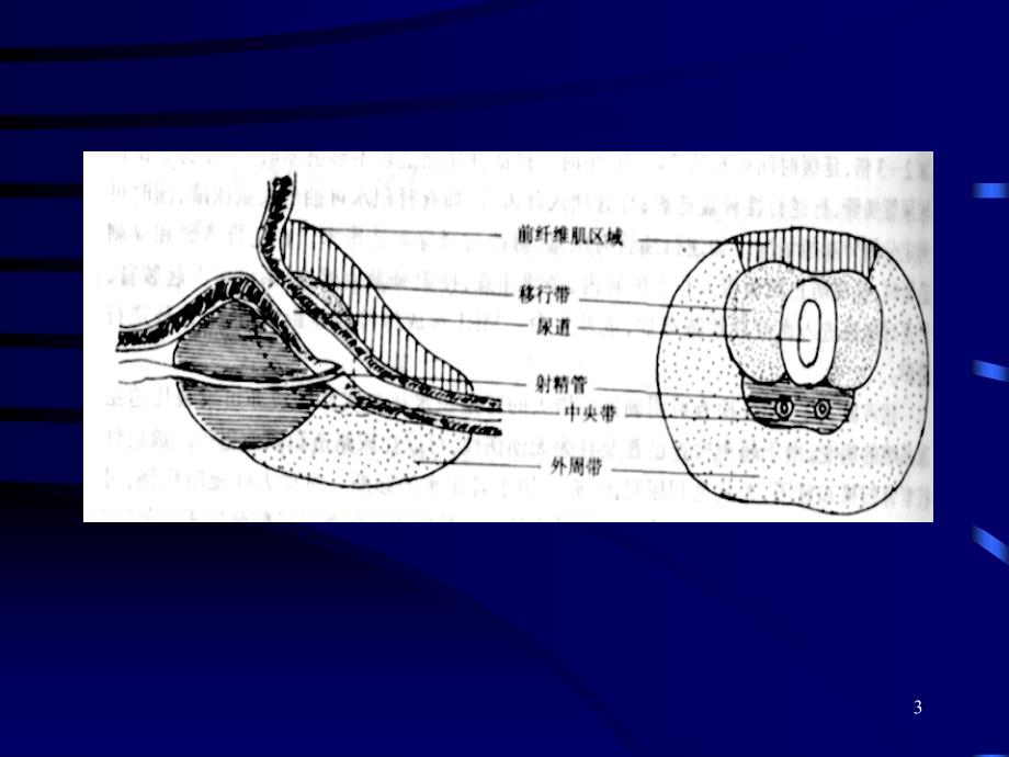 前列腺增生症的临床表现诊断和治疗讲解材料_第3页