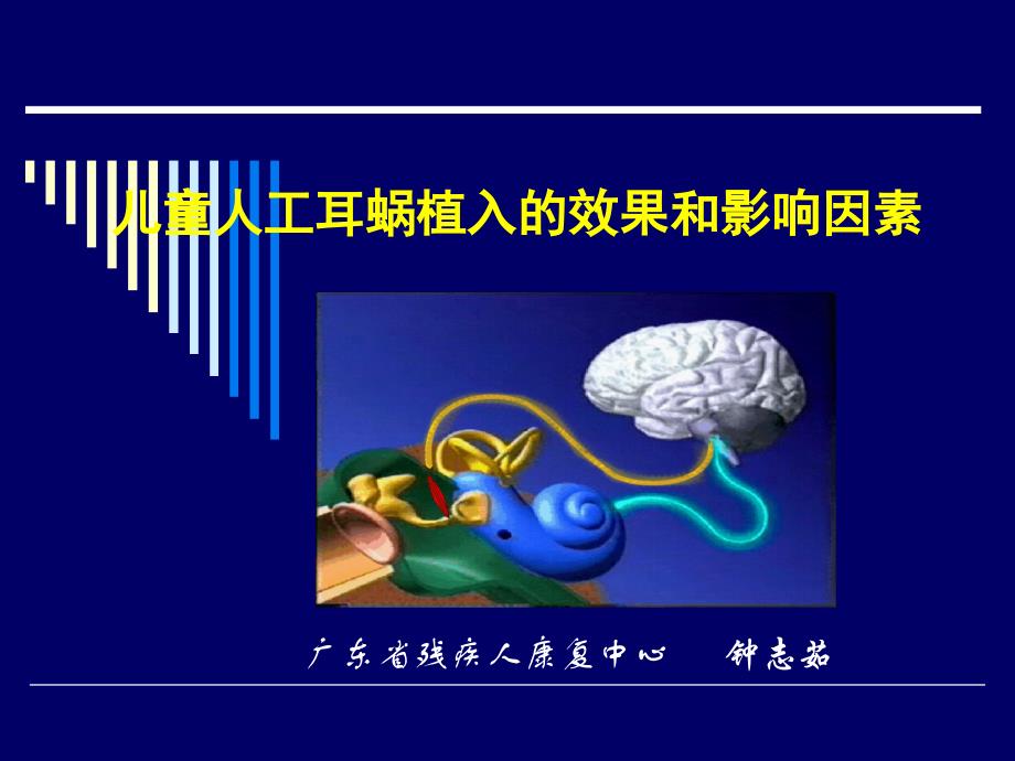 钟志茹——儿童人工耳蜗植入的效果和影响因素教学案例_第1页