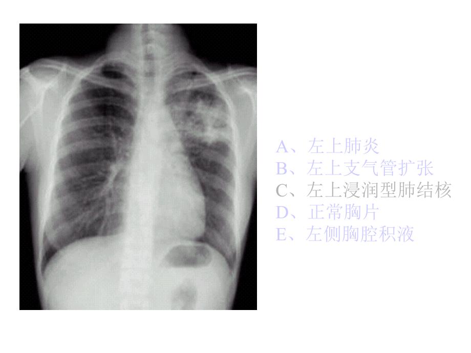 执业医师操作考试(X光片)知识分享_第2页