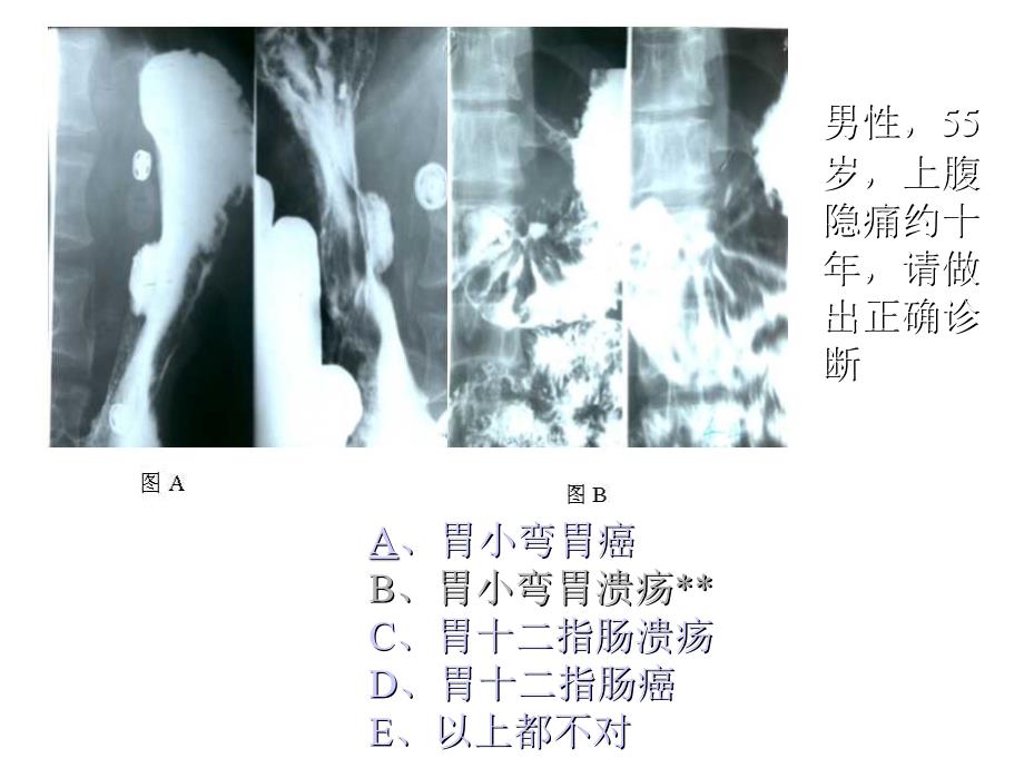 执业医师操作考试(X光片)知识分享_第4页