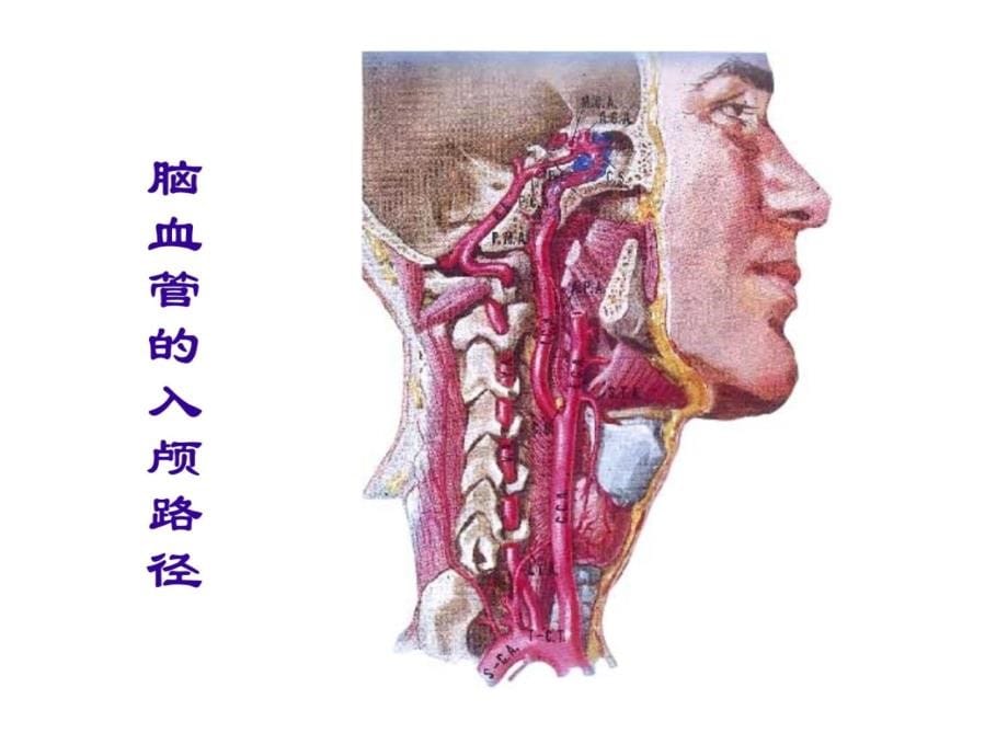 脑血管病-神经内科课件 (1)教学案例_第5页