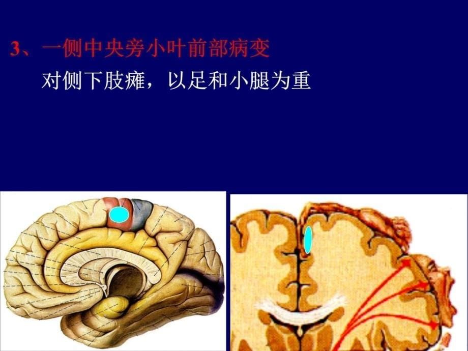 临床神经解剖-3培训讲学_第5页