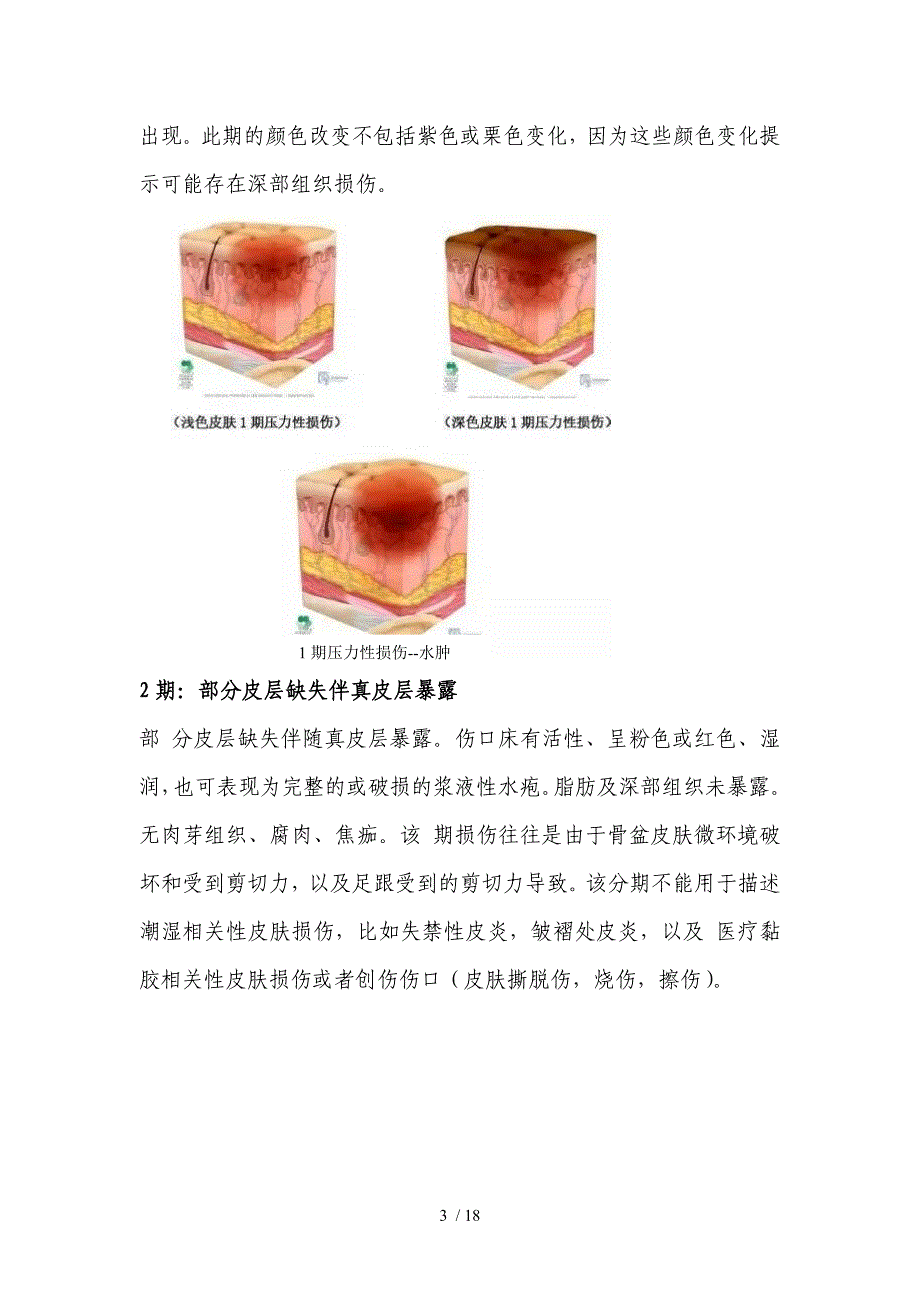 2018年最新的压疮诊疗护理规范_第4页