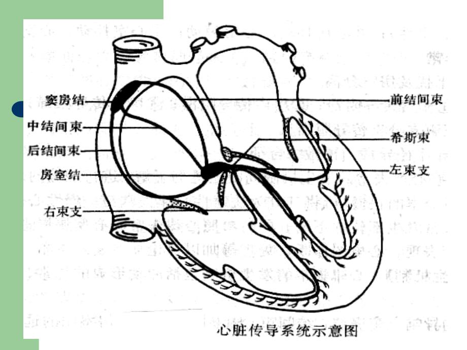 心律失常(Arrhythmia)教学材料_第3页