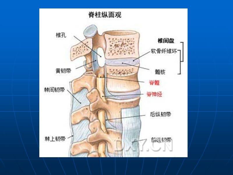 有关腰椎间盘脱出培训资料_第4页