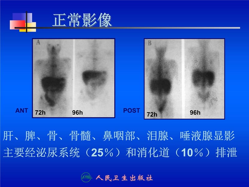 第十三章炎症显像研究报告_第5页