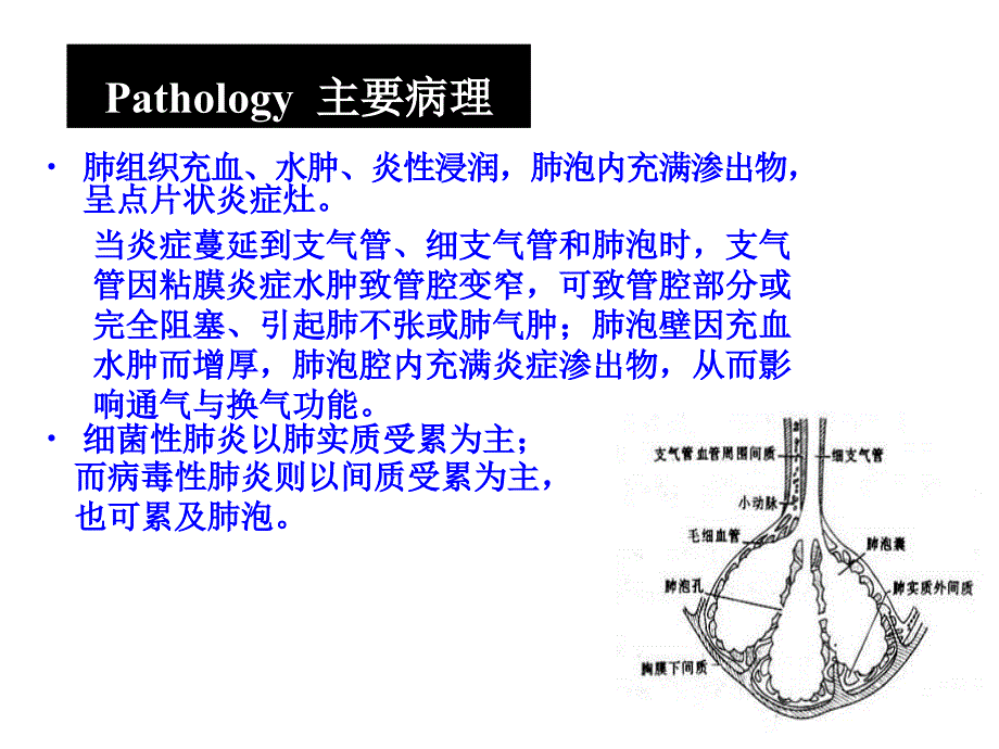 呼吸系统疾病2：支气管肺炎指南_第4页