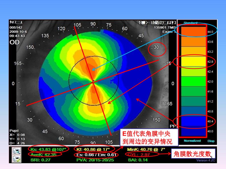 图说角膜地形图PPT幻灯片课件_第3页