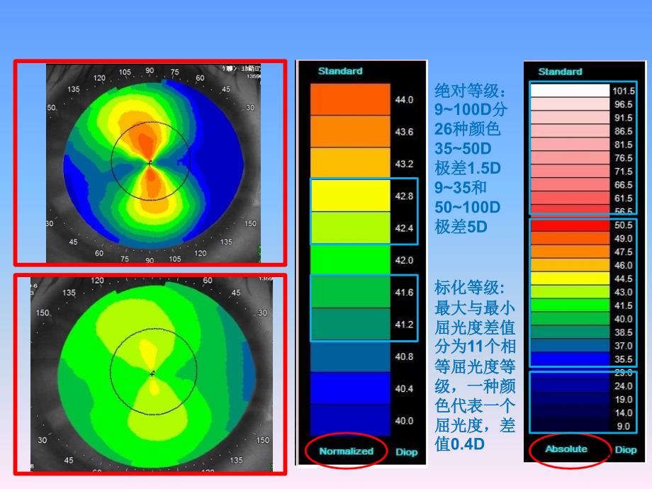 图说角膜地形图PPT幻灯片课件_第4页