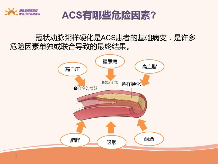 ACS患者如何改善生活方式_第3页