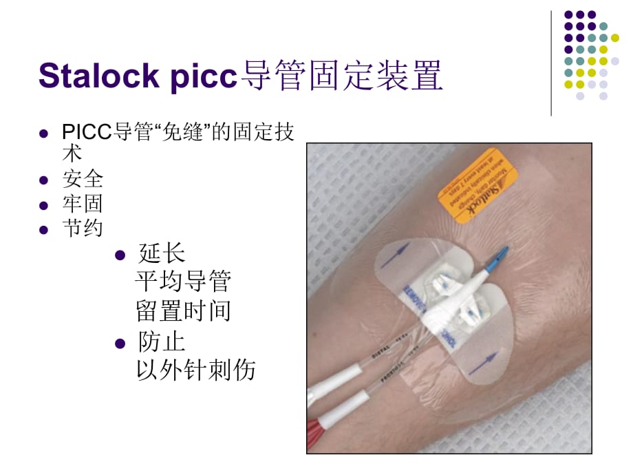 Stalock-picc导管固定装置(思乐扣)_第1页