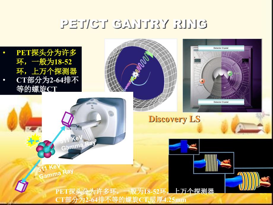 PET-CT在高端体检中的应用--课件_第4页