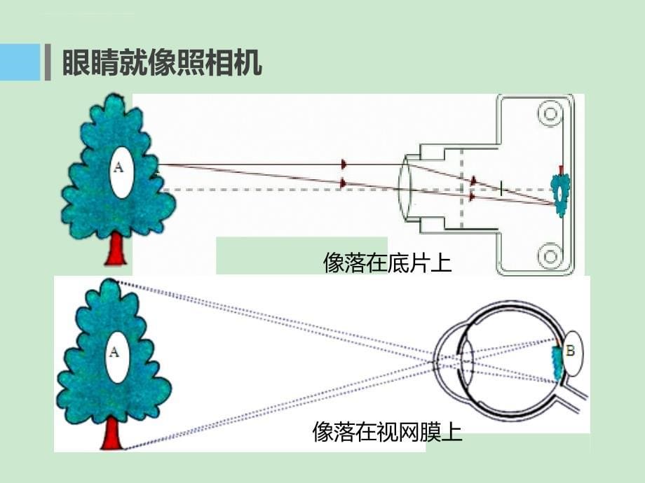 一起认识近视眼_第5页