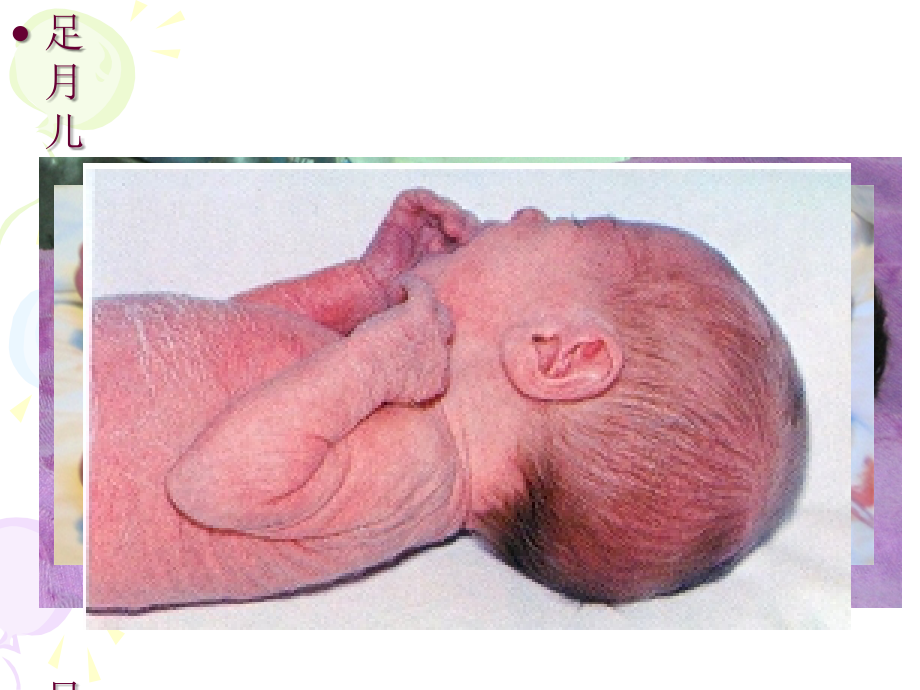 新生儿的护理(母婴护理专用)_第4页