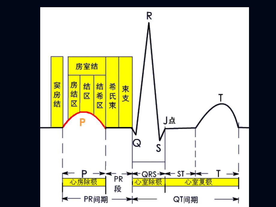 心电图2—肥大缺血_第2页