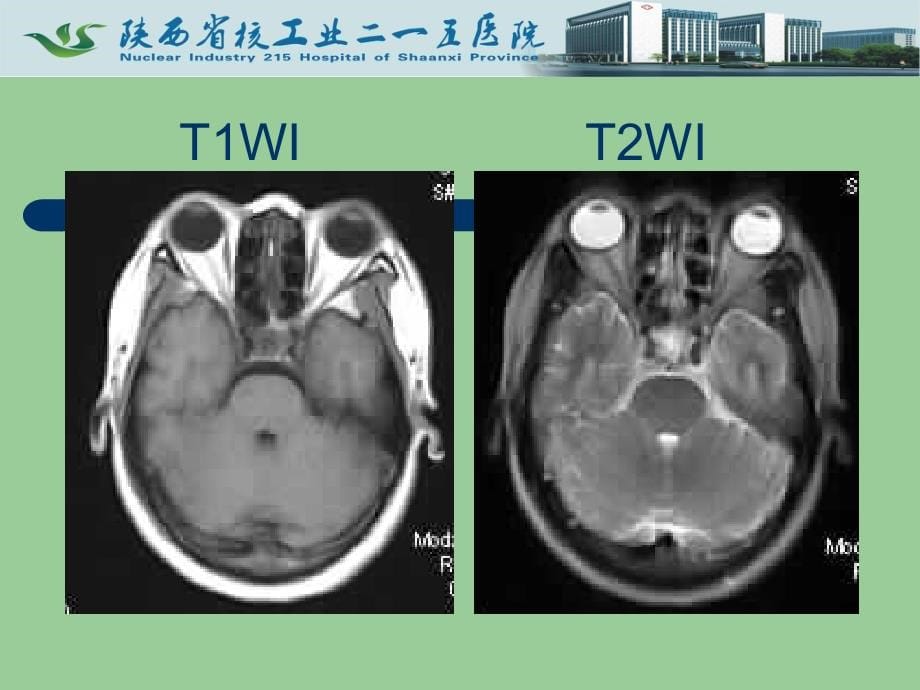 头颈部影诊断课件资料_第5页