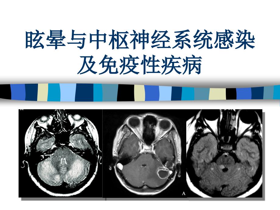 眩晕与中枢神经系统感染及免疫性疾病_第1页