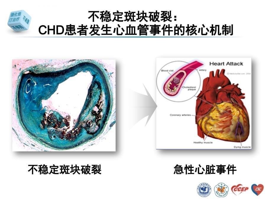 他汀抗动脉粥样硬化的基石_第5页