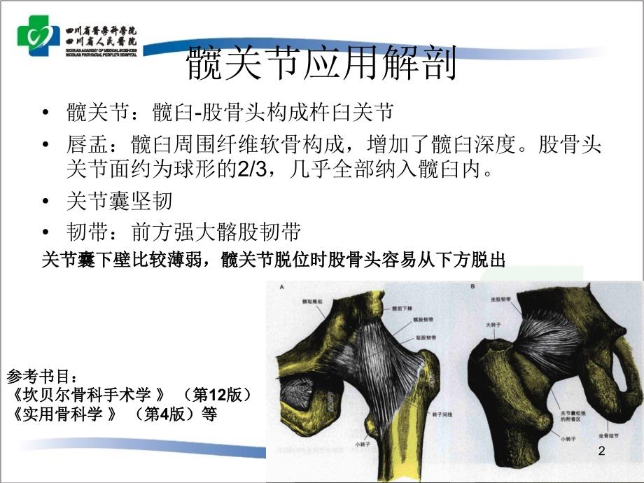 髋关节脱位-PPT幻灯片课件_第2页