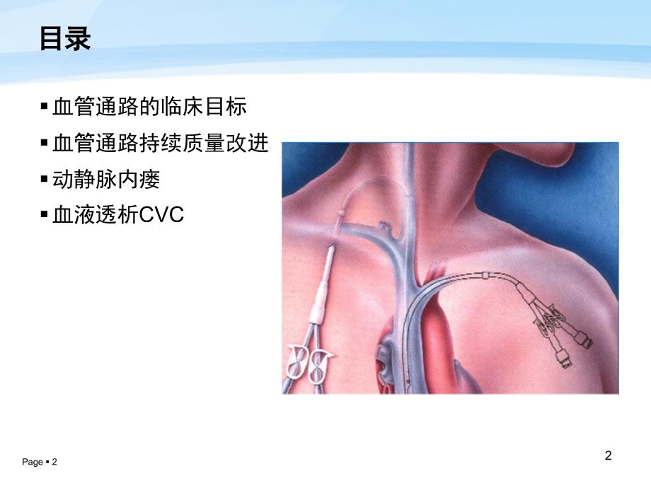 1.15中国血液透析用血管通路专家共识教程文件_第2页