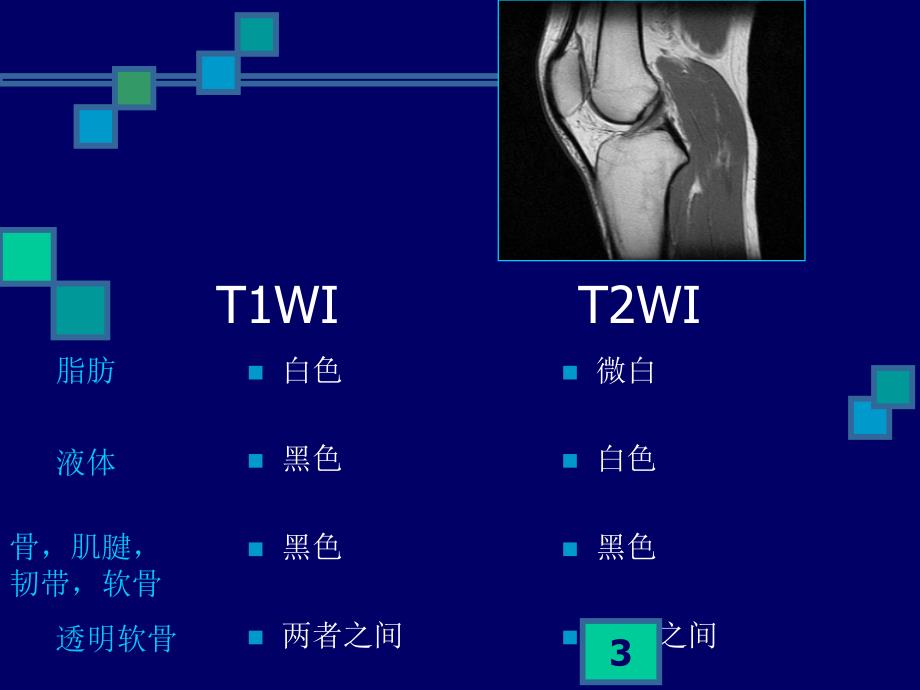 膝关节MRIPPT幻灯片课件_第3页