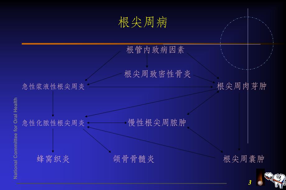 牙髓病和根尖周病的治疗ppt课件_第3页