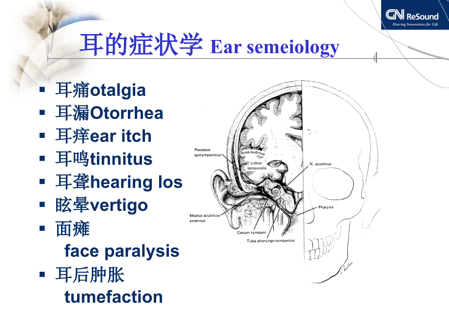 耳聋相关疾病与听力图分析PPT演示幻灯片_第2页