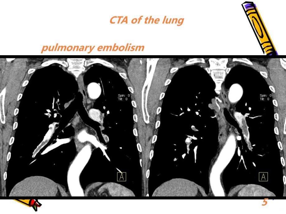 CT临床应用PPT课件_第5页