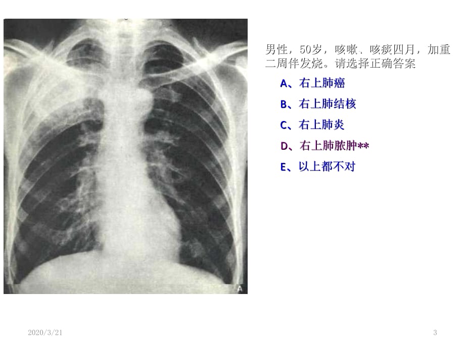 执业医师技能考试第三站测试题目2PPT演示幻灯片_第3页