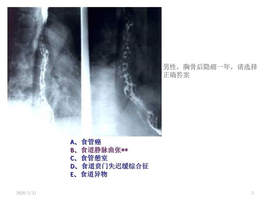 执业医师技能考试第三站测试题目2PPT演示幻灯片_第5页