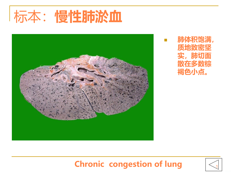 病理学实验大体标本+有病理诊断ppt课件_第1页