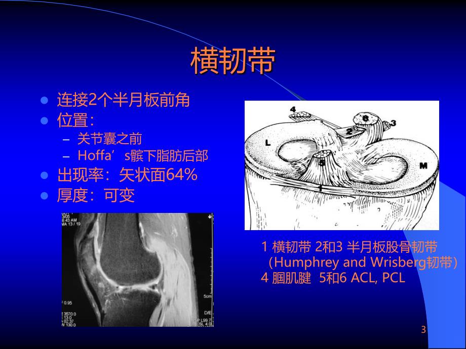 MRI在膝关节创伤的应用ppt课件_第3页