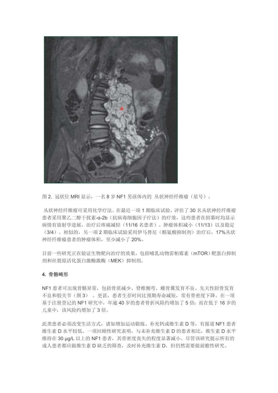 1型神经纤维瘤病相关肿瘤诊疗进展(综述)应用.doc_第4页