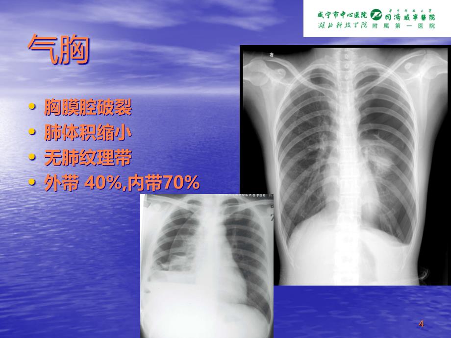 临床x线判读PPT课件_第4页