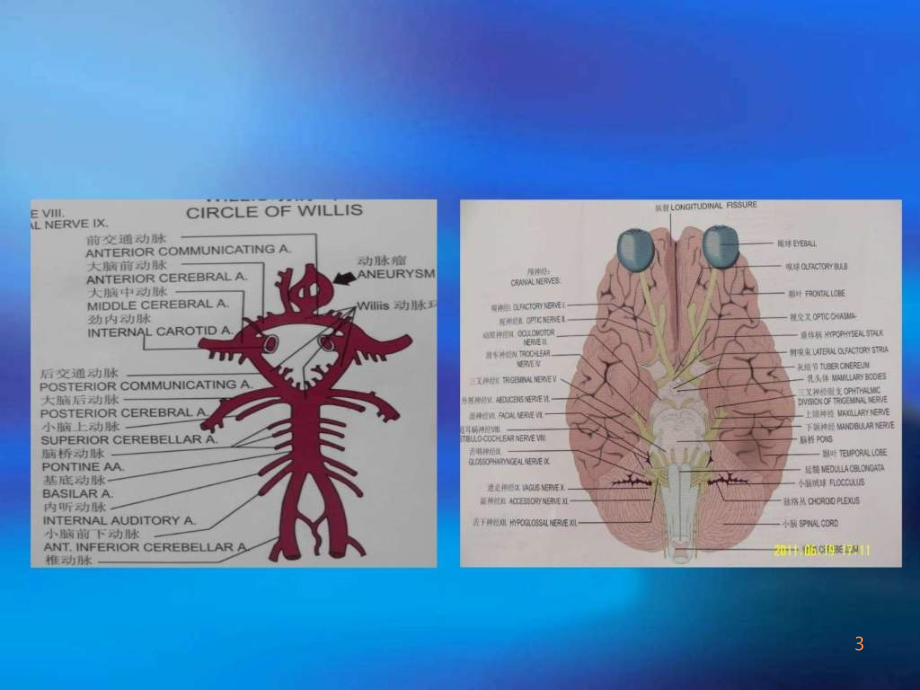 年脑梗死的诊断与治疗ppt课件_第3页