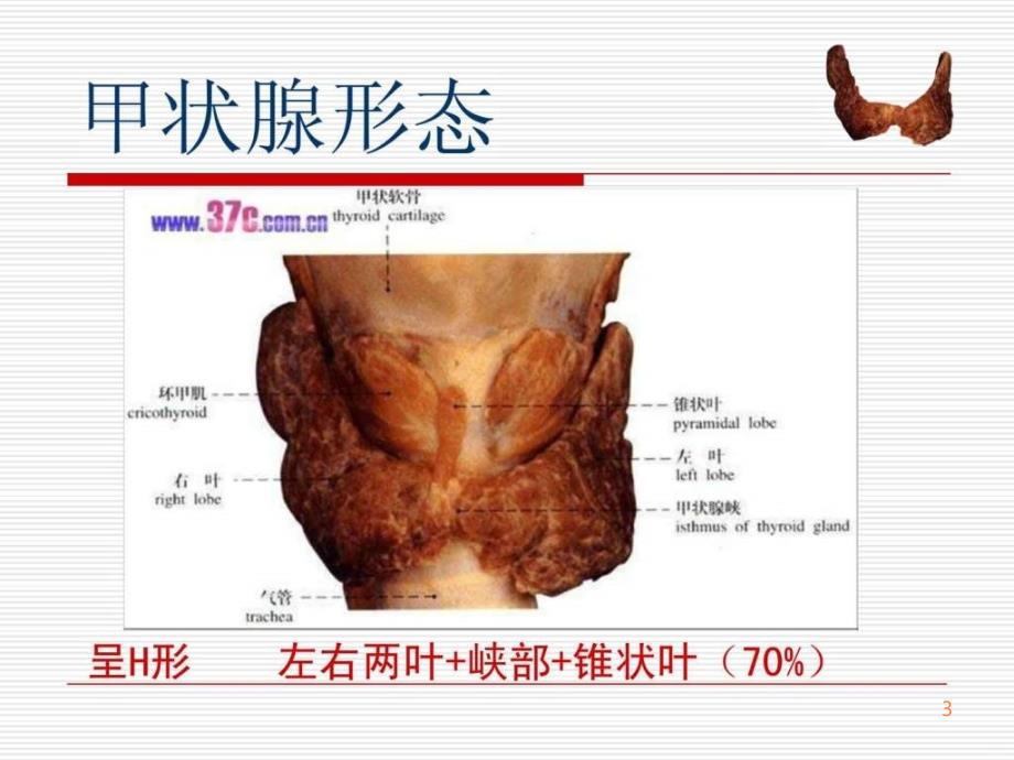 甲状腺肿瘤的护理PPT课件_第3页