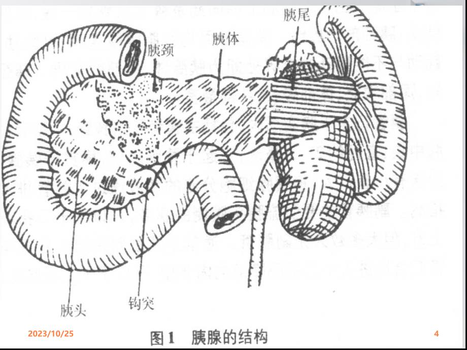 急性胰腺炎课件PPT课件_第4页