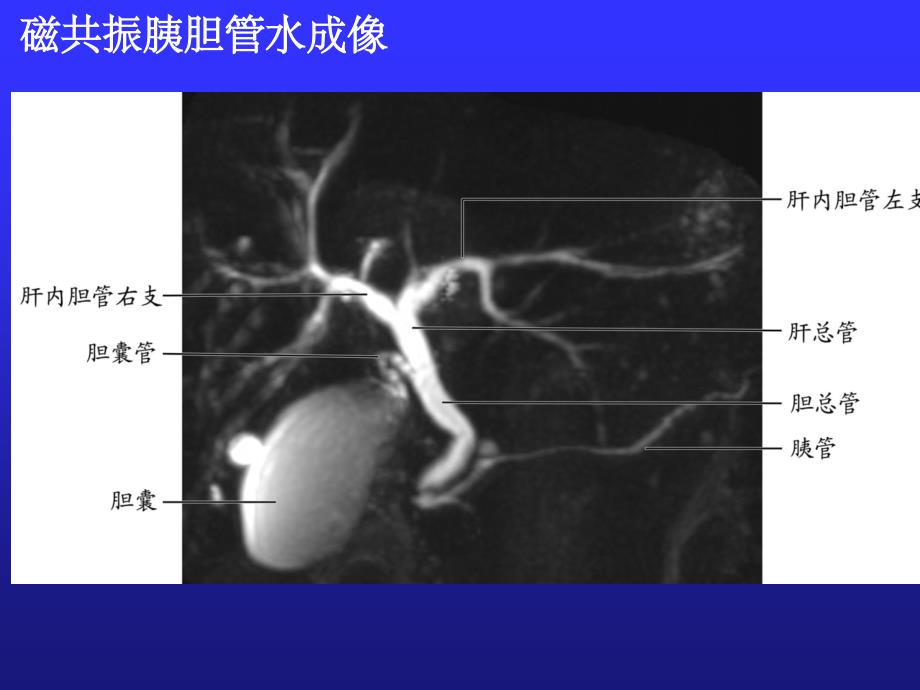 儿童急性胰腺炎ppt精选课件_第4页