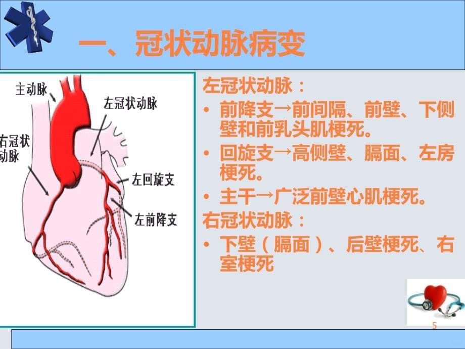 急性心梗的急救与护理ppt课件_第5页