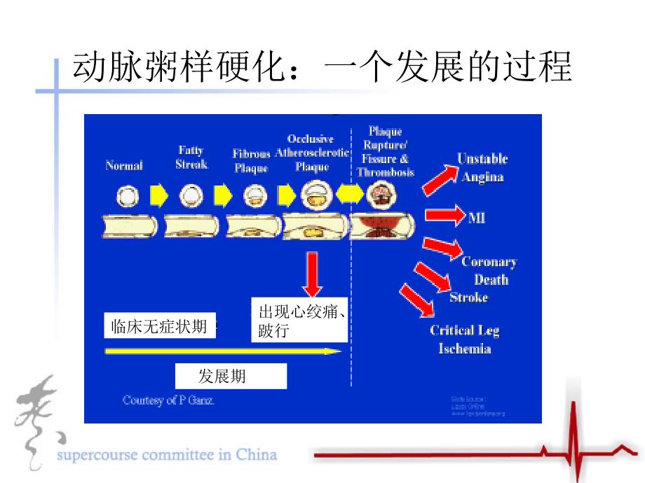 急性冠脉病症的病理机制ppt课件_第3页