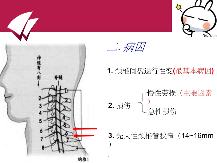 颈椎病ppt精选课件_第4页