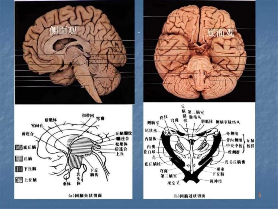 间脑病变的定位诊PPT课件_第5页