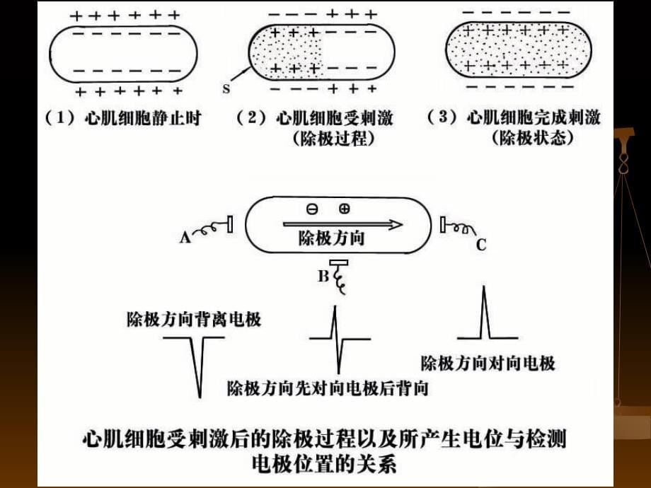 心电图基本知识精10316PPT课件_第5页