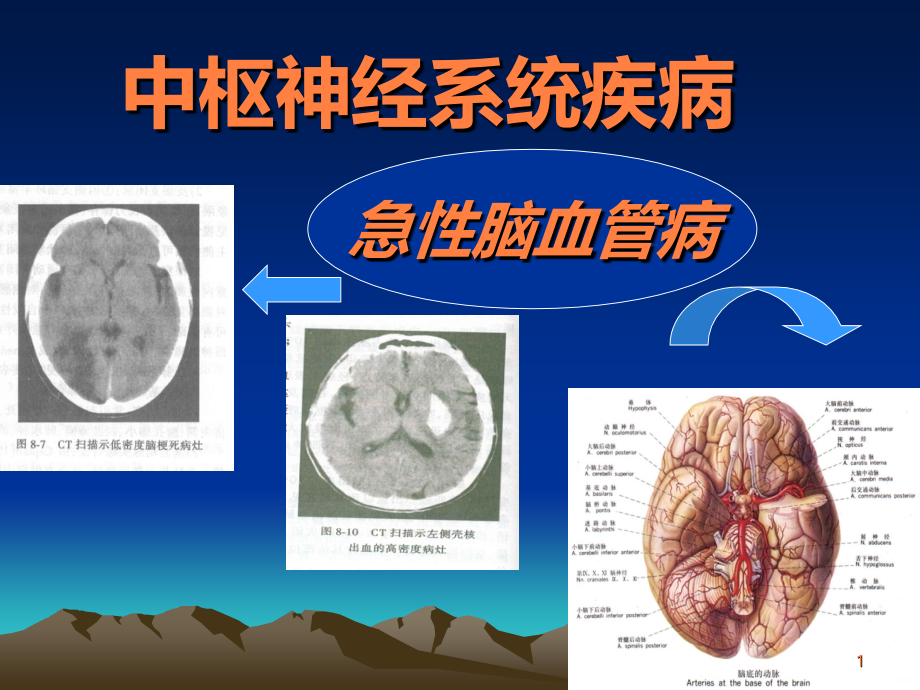 急性脑血管病(简) ()ppt课件_第1页