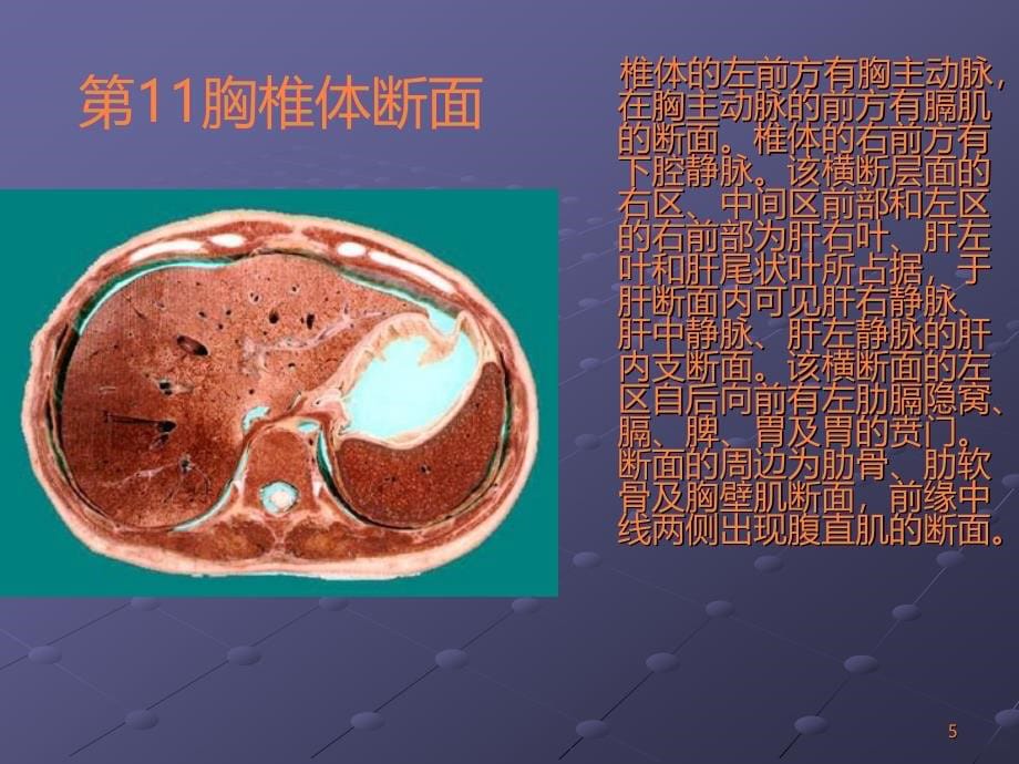 临床腹部CT阅片基础ppt课件_第5页