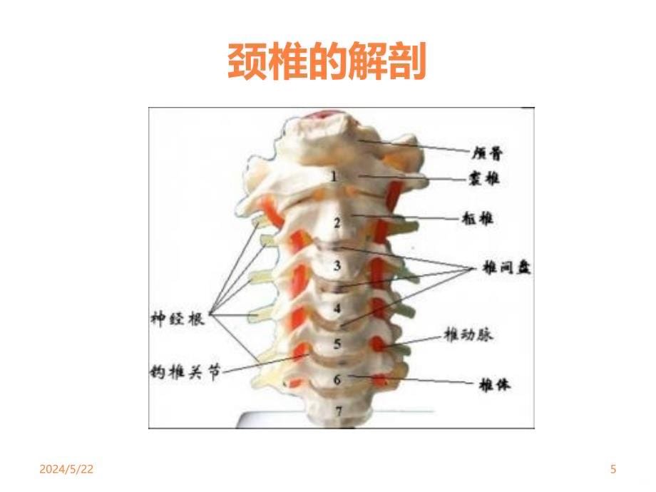 颈椎病防治PPT课件_第5页