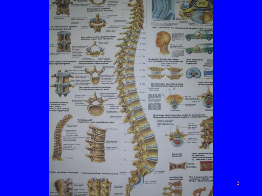 脊柱和骨盆骨折ppt课件_第3页